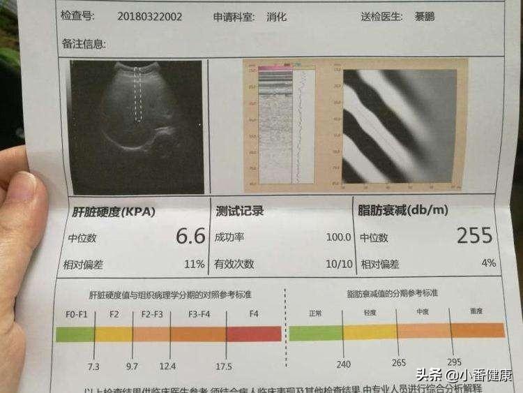 乙肝最新消息，研究突破與未來展望